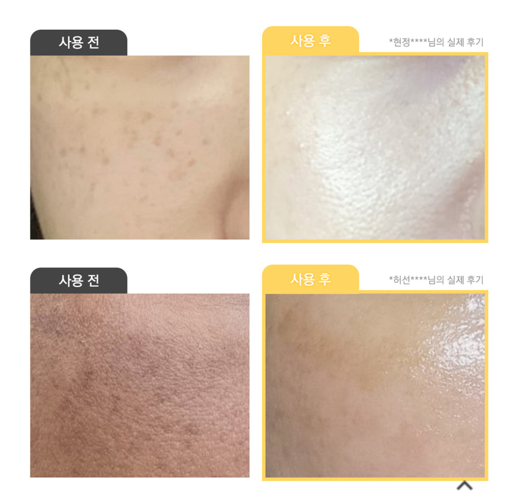 VARI HOPE 8 Days Vitamin C Serum