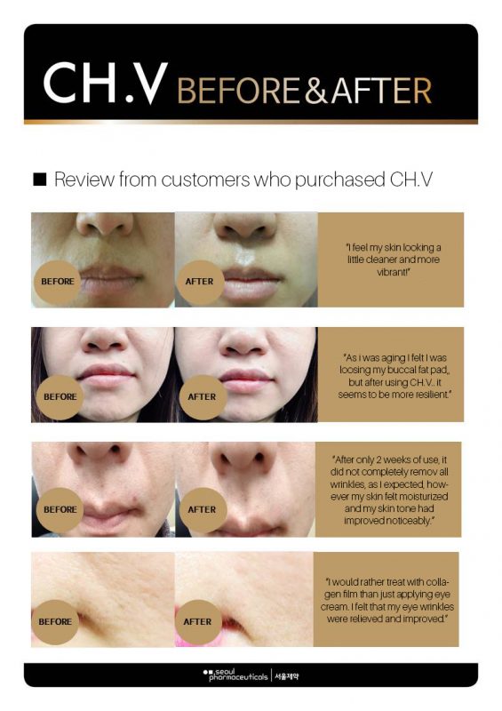 Seoul Pharmaceutical CH.V Collagen Smart Film - Angie&Ash
