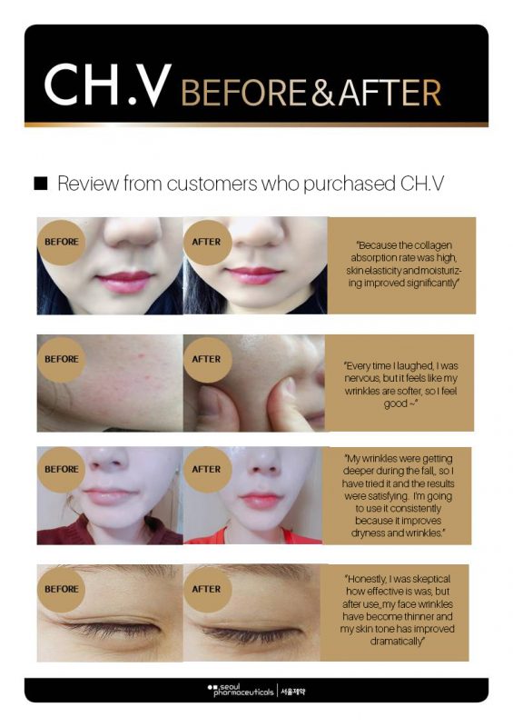 Seoul Pharmaceutical CH.V Collagen Smart Film - Angie&Ash