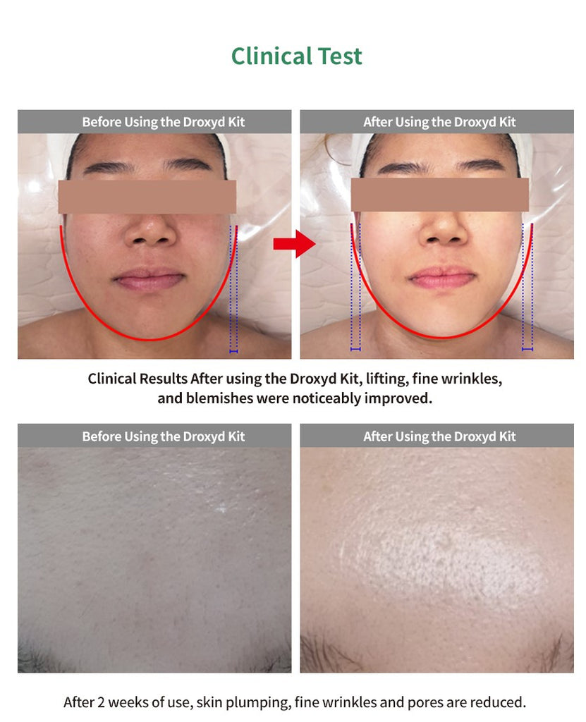 Oxitical DROXYD KIT_공구구성